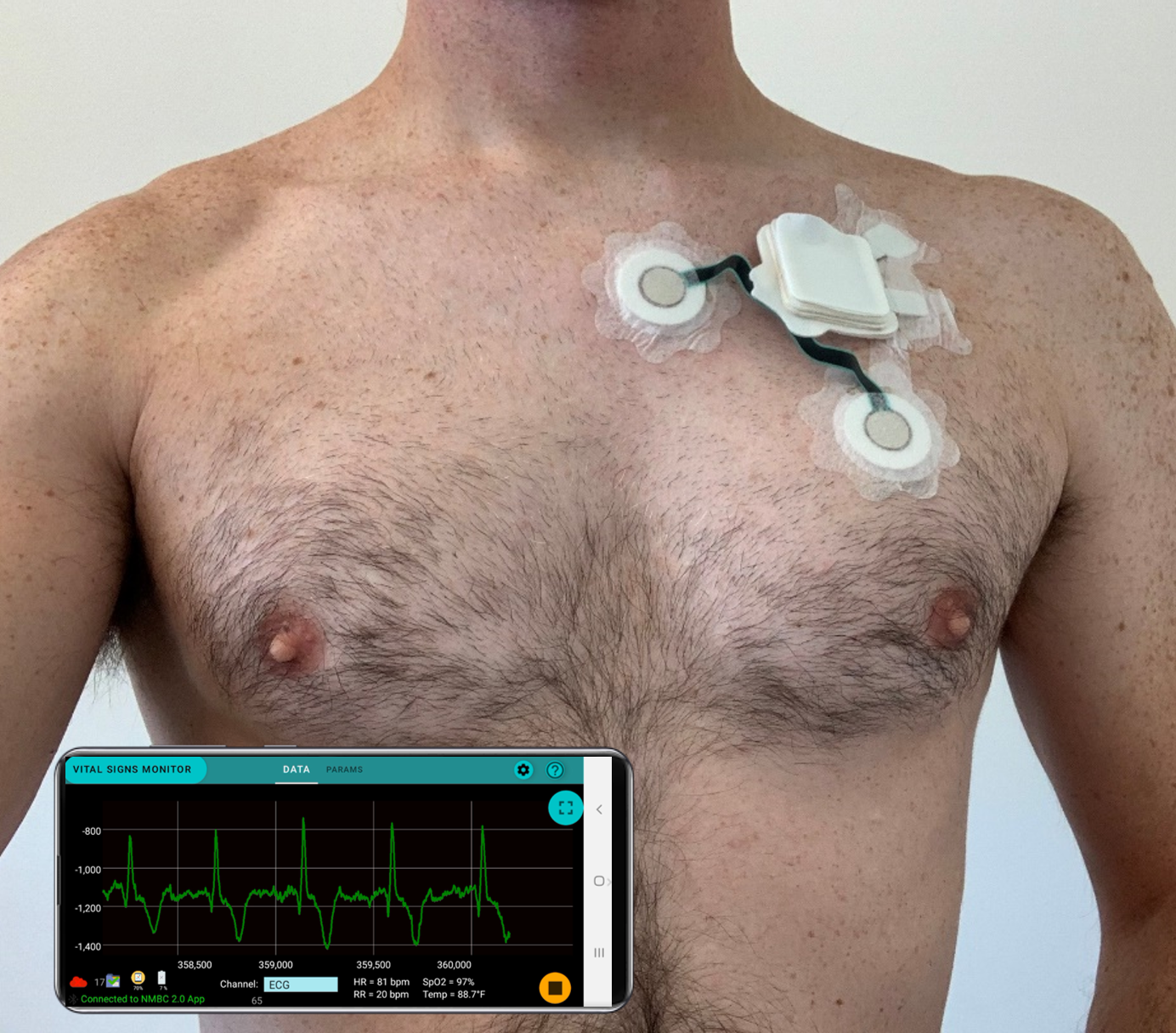 GE Wearable