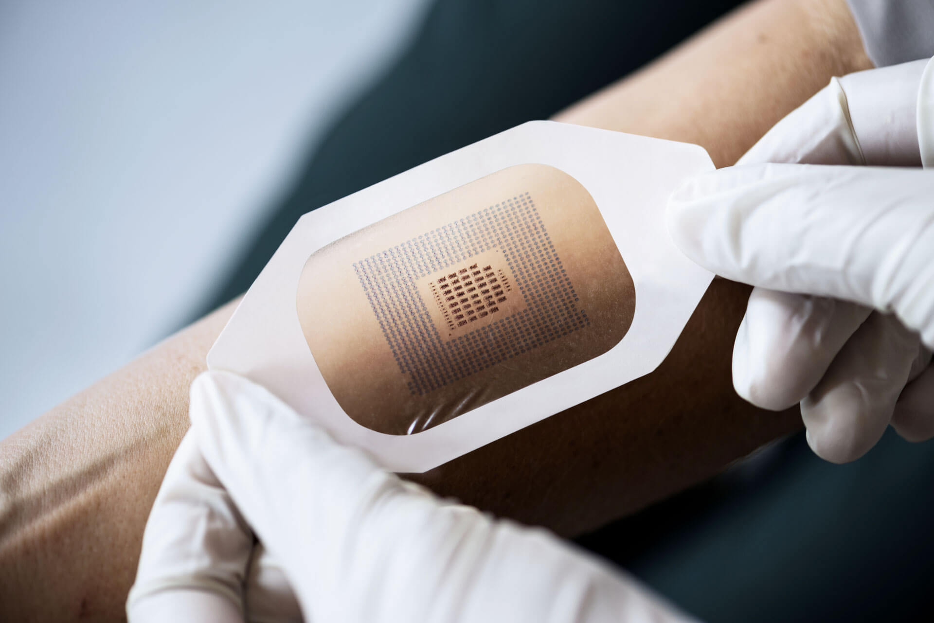 Sticking to Skin – Tapes and Patches for Wearable Medical Devices